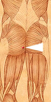 BL35 . Hui Yang